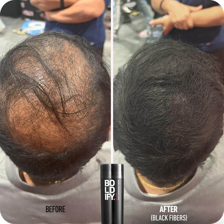 Hair Fibers - Buy Boldify Hair Fibers Online - 12g Before and After | Fitaminat