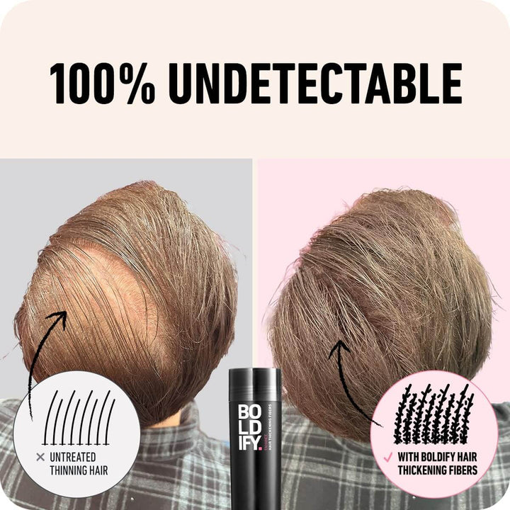 Boldify Hair Thickening Fibers - 28 g 100% Undetectable | Fitaminat